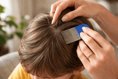 طفل يتم فحص فروة رأسه بمشط خاص لإزالة القمل