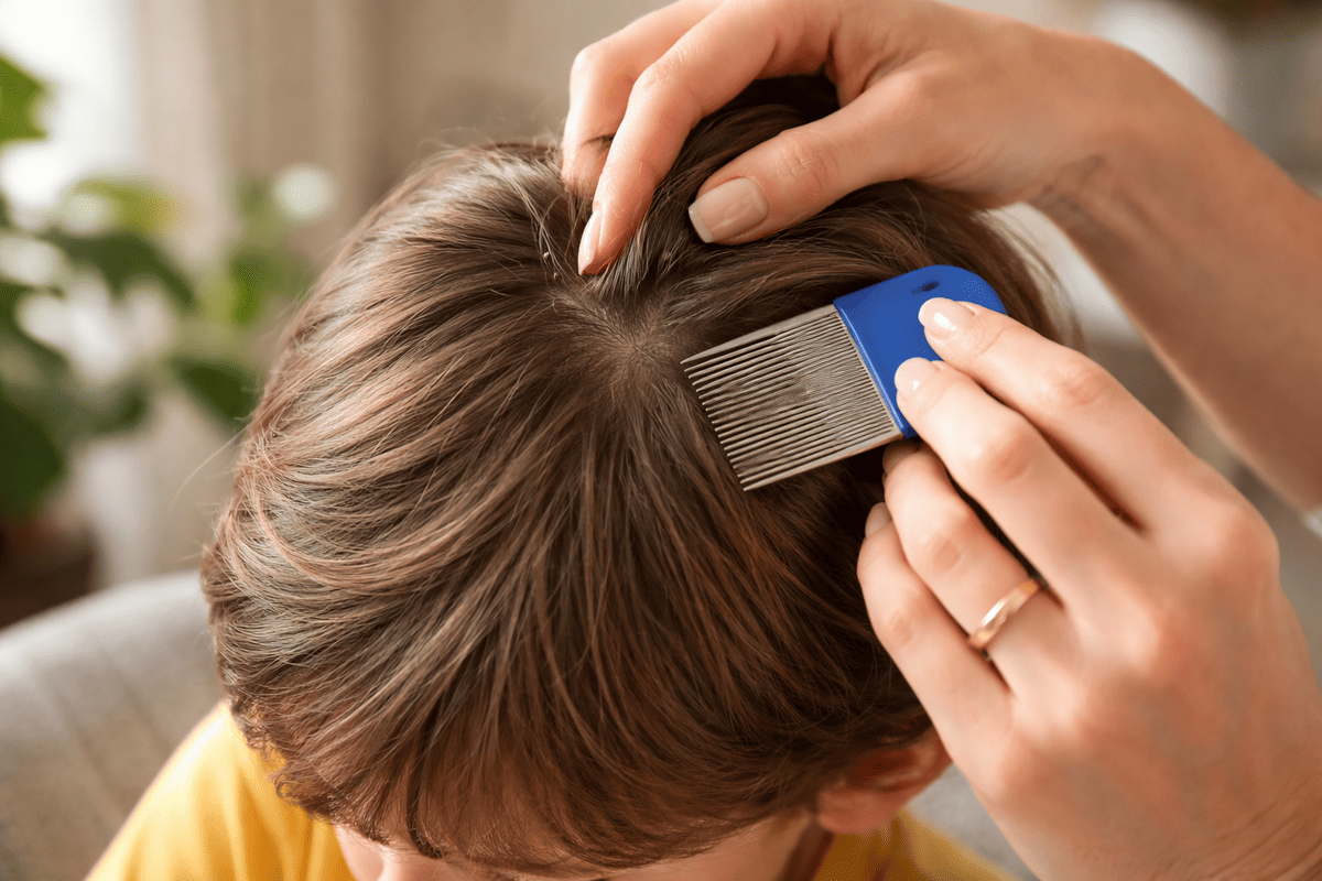 طفل يتم فحص فروة رأسه بمشط خاص لإزالة القمل